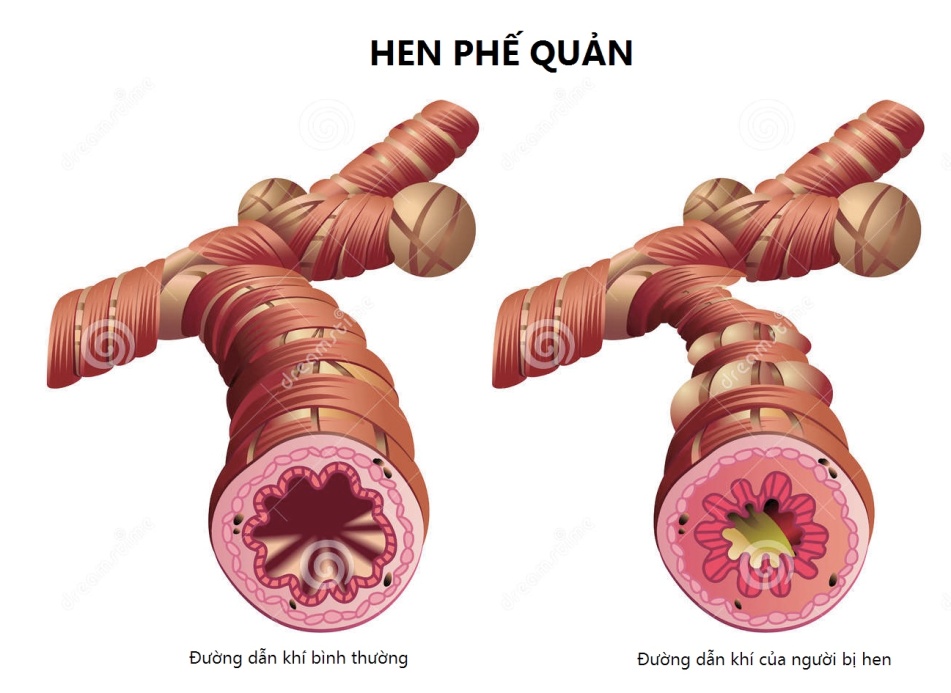 meo-dan-gian-chua-hen-suyen-tiep-thi-gia-dinh-1